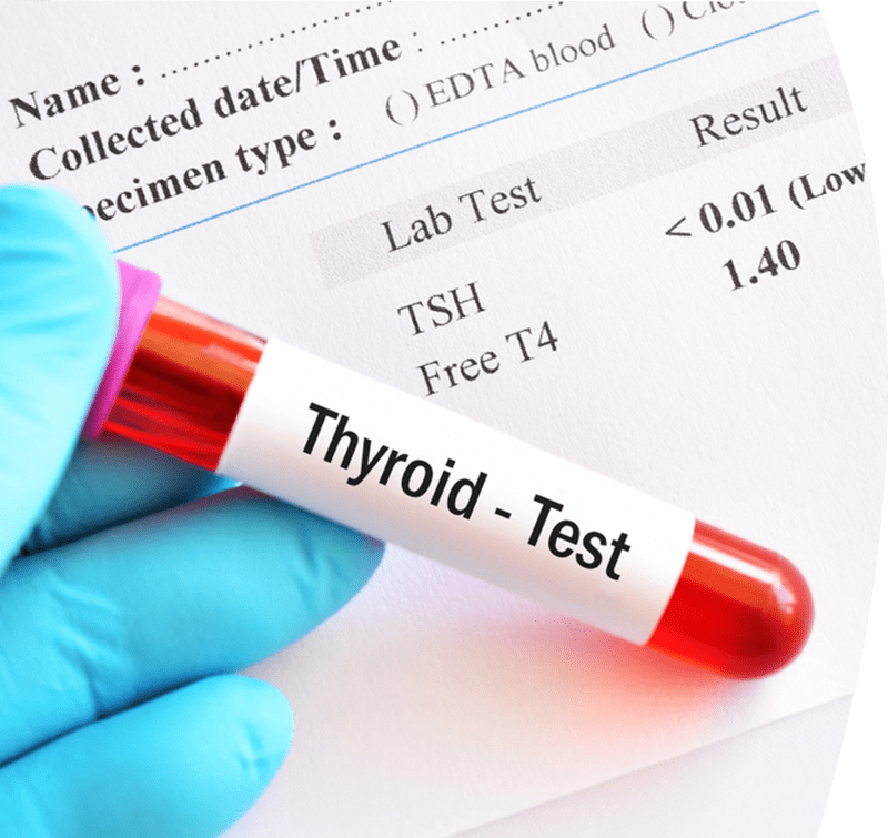 thyroid